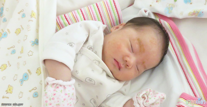 วันนี้อายุครบ 4 วีคแล้ว mayrin_4weeks